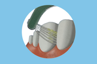 เทคโนโลยีบูเลดัน